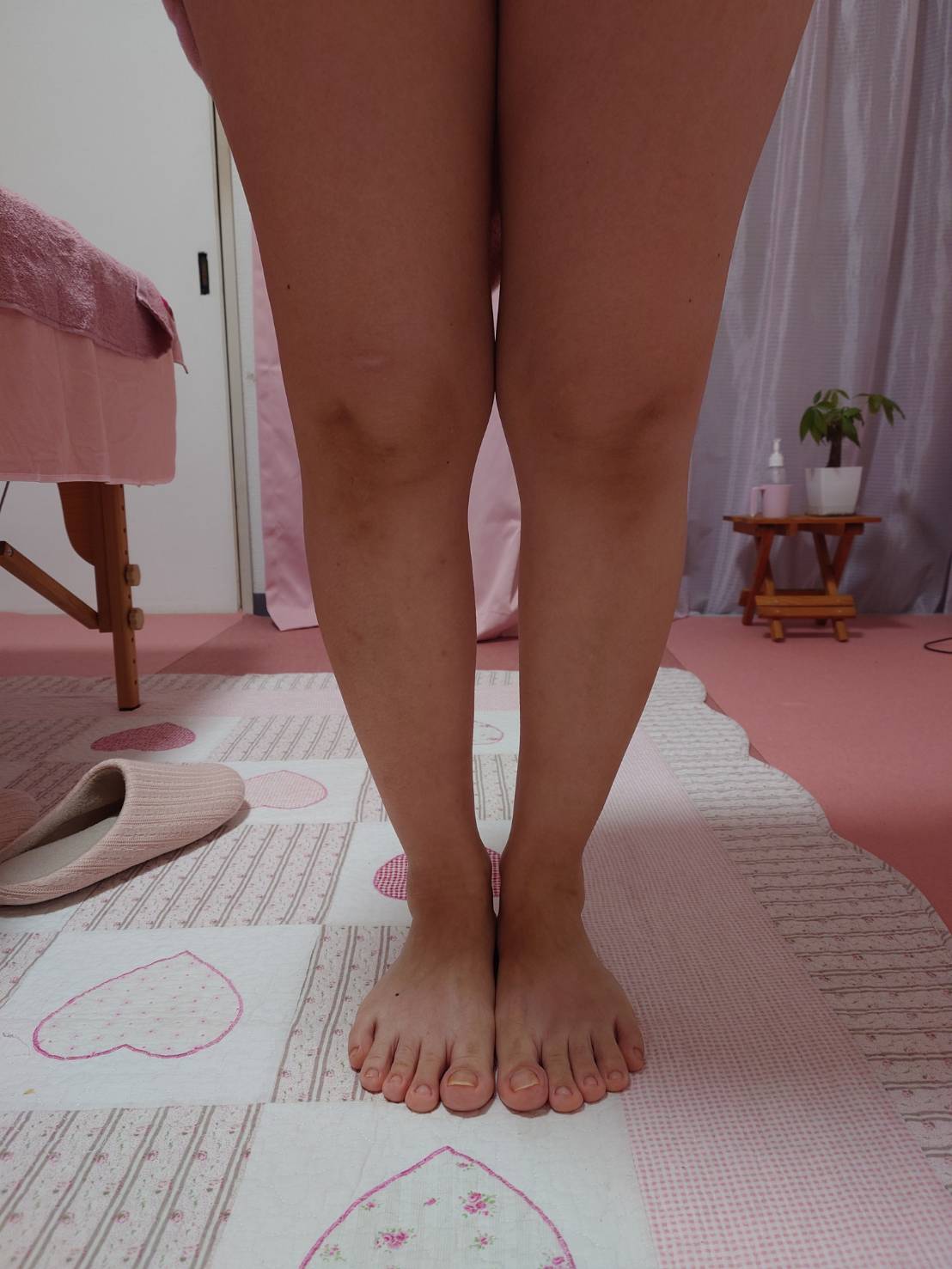 足のむくみと足の歪みがお悩みでご来店。